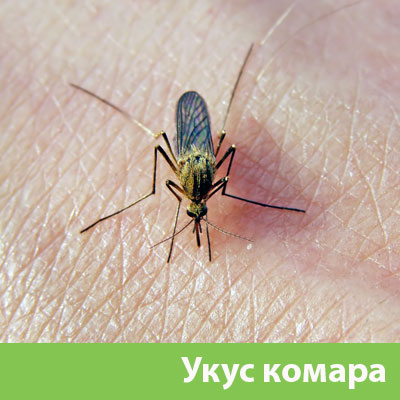 Укусы комаров в Туле