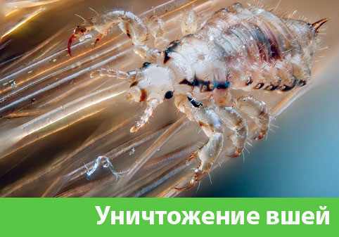 Уничтожение вшей в городе Тула